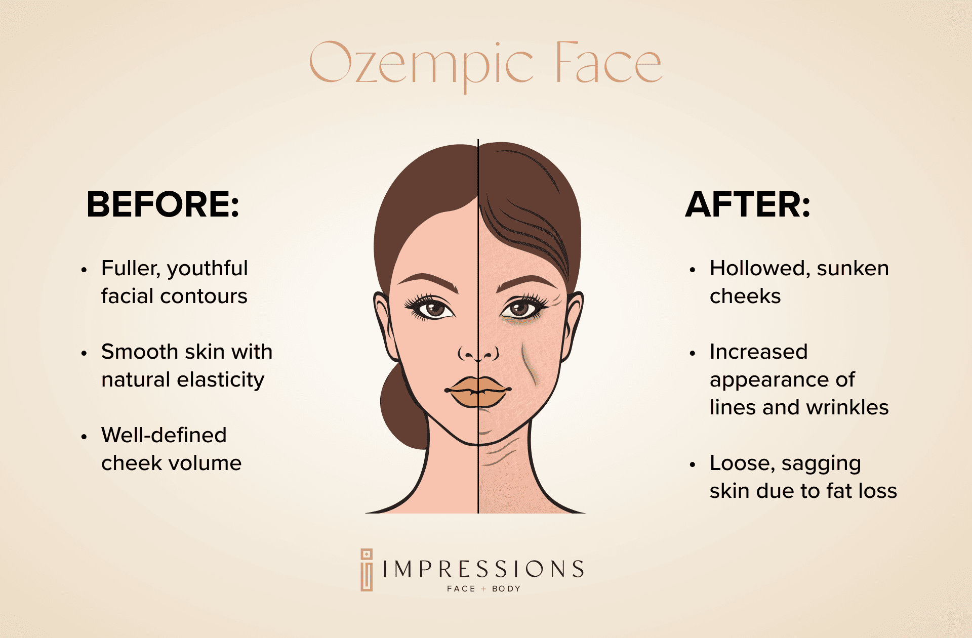 Commonly Affected Areas by Ozempic Face