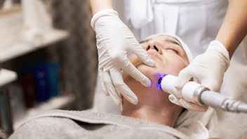 Laser Skin Correcting Reduce Dark Spots and Hyperpigmentation Through Lasers