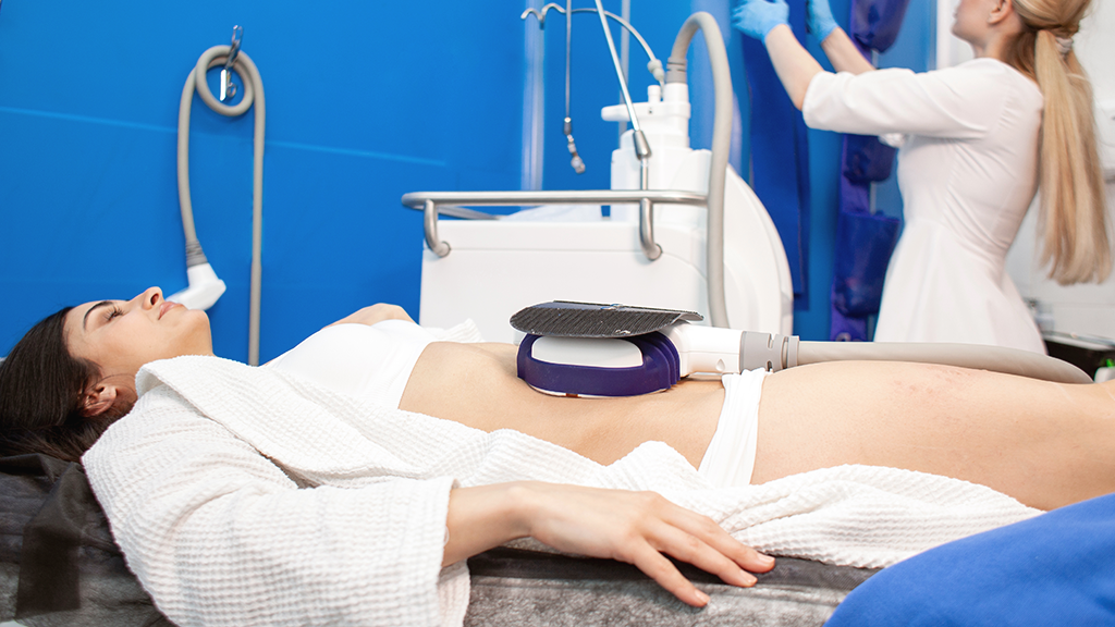 CoolSculpting